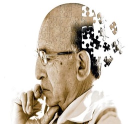 Alzheimer